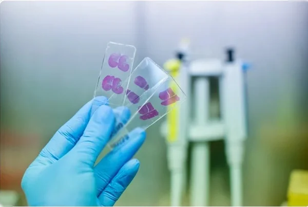 HISTOPATHOLOGY SLIDE ISSUE