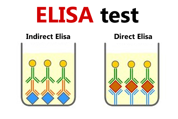 Elisa